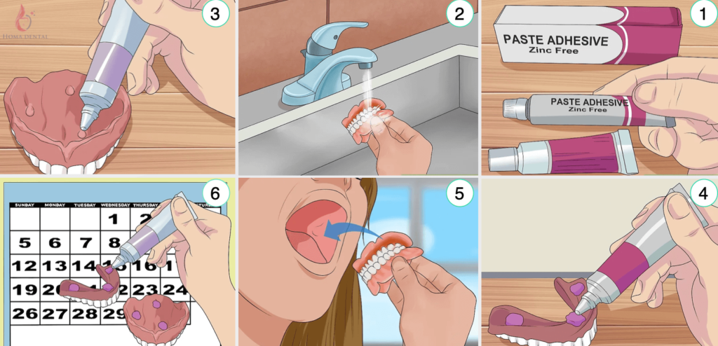 مراحل استفاده صحيح از چسب دندان مصنوعی