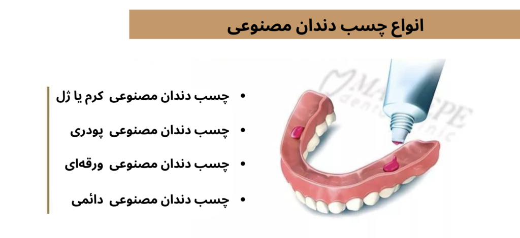 انواع چسب دندان مصنوعی