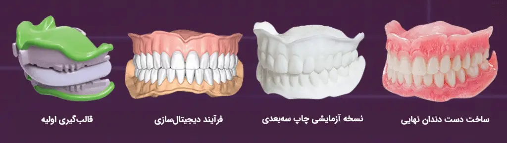 مراحل ساخت دندان مصنوعی دیجیتال