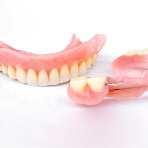 flexible-partial-dentures